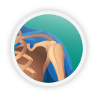 shoulder / arm injury