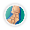 ankle injury