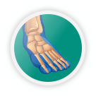 foot injury